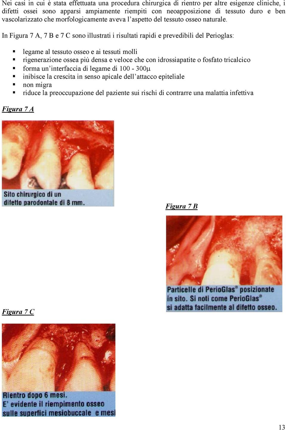 In Figura 7 A, 7 B e 7 C sono illustrati i risultati rapidi e prevedibili del Perioglas: legame al tessuto osseo e ai tessuti molli rigenerazione ossea più densa e veloce che con