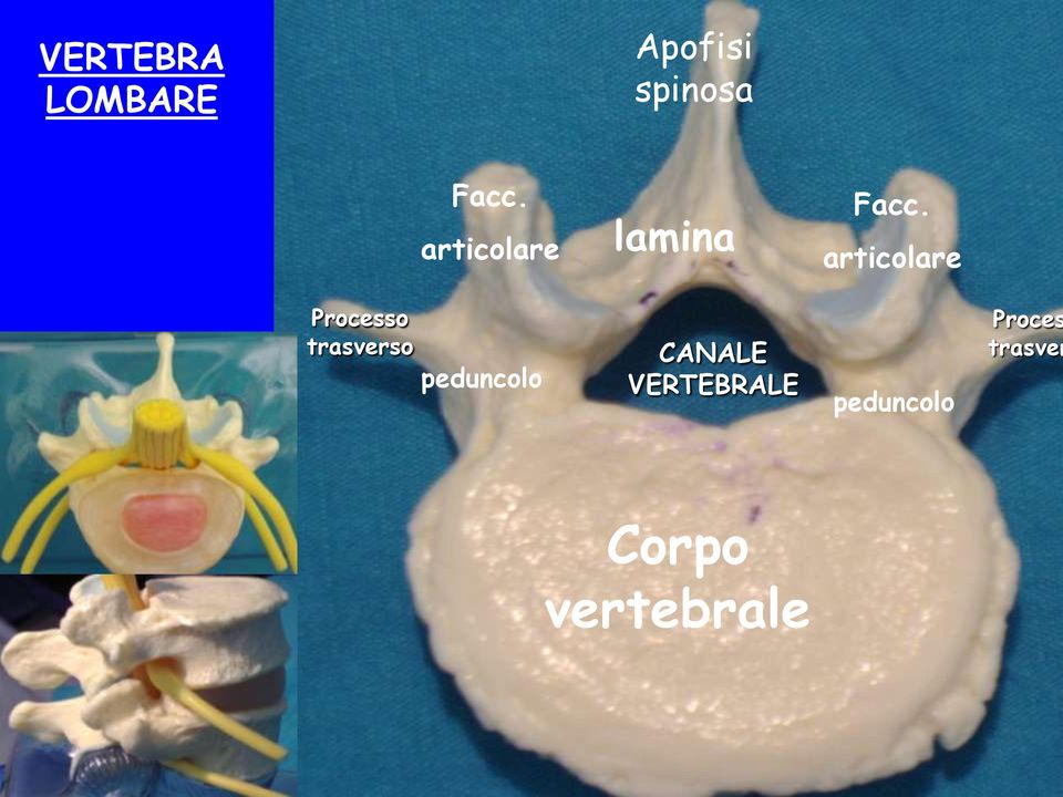 articolare Processo trasverso peduncolo