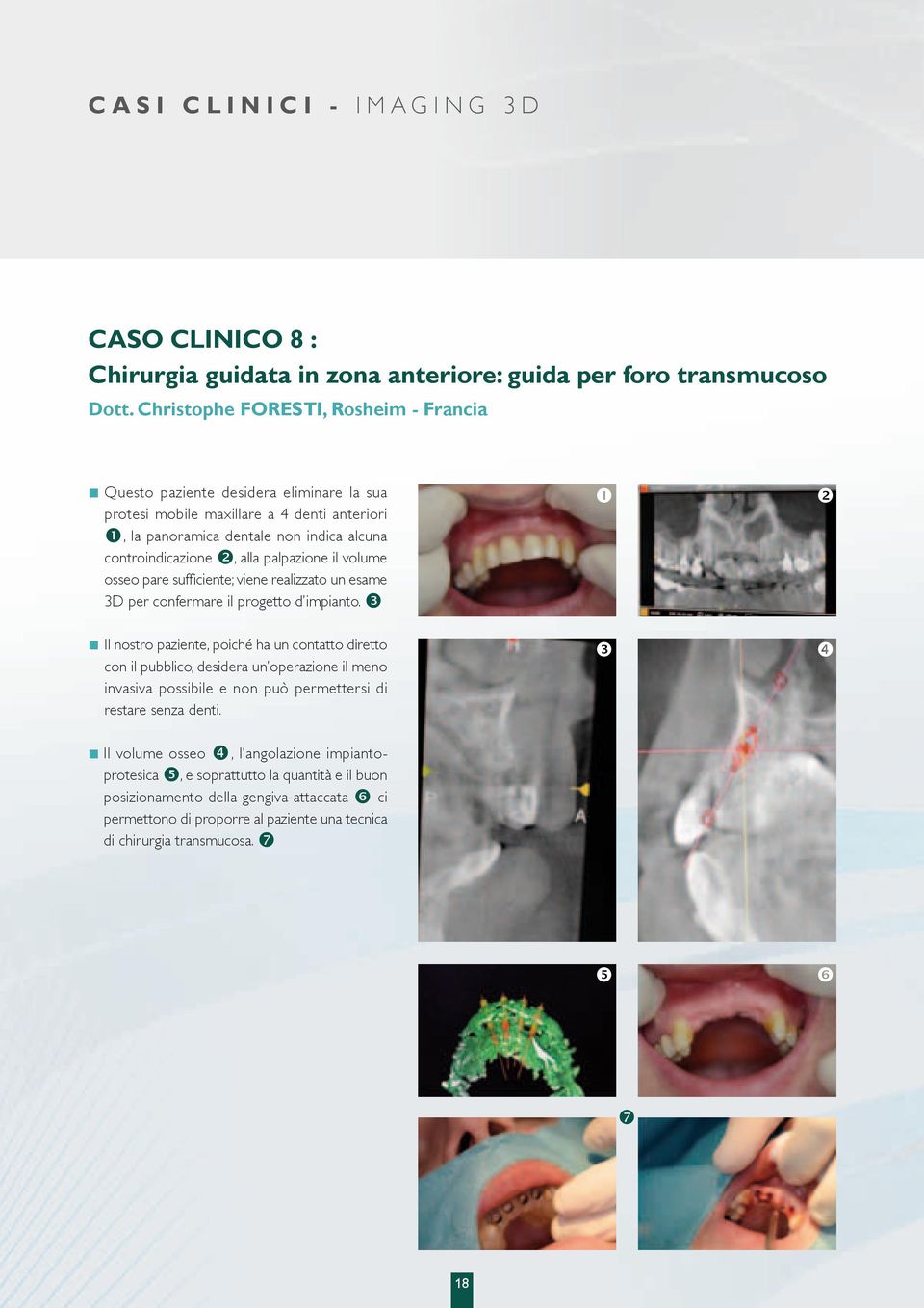 impianto. Il nostro paziente, poiché ha un contatto diretto con il pubblico, desidera un operazione il meno invasiva possibile e non può permettersi di restare senza denti.