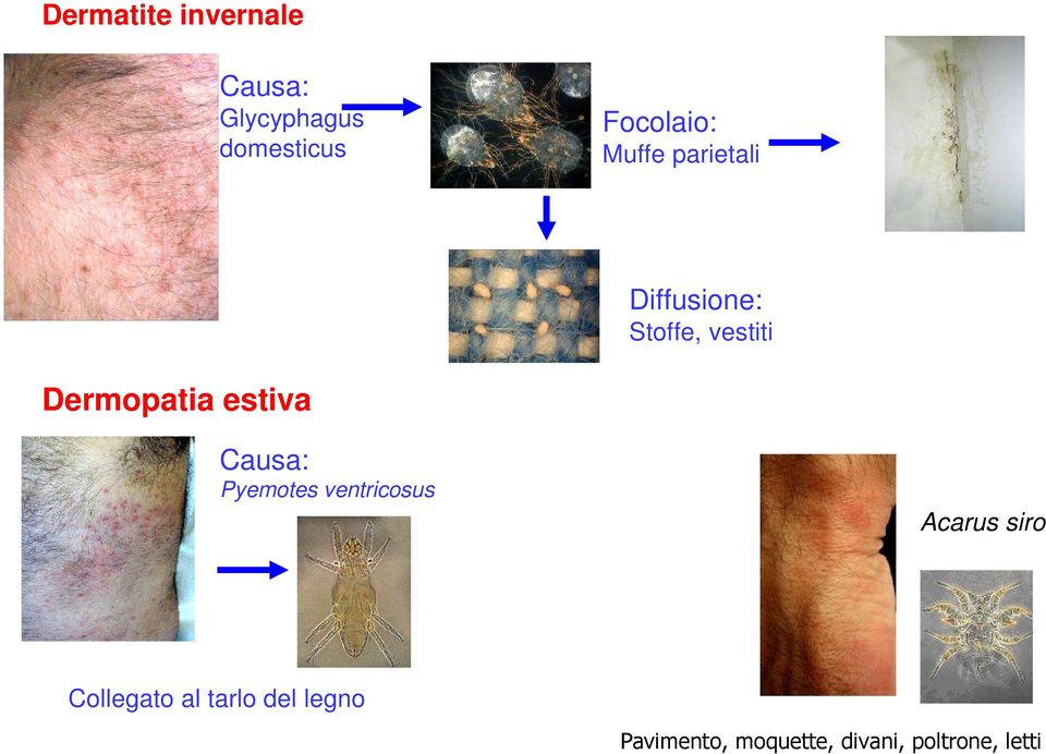 Dermopatia estiva Causa: Pyemotes ventricosus Acarus siro