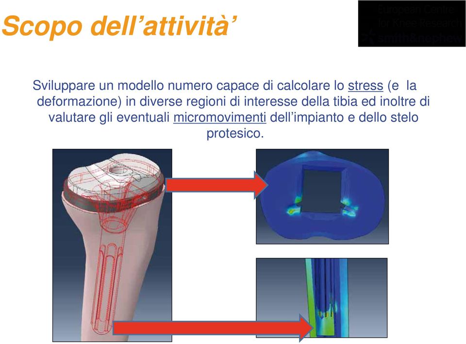 di interesse della tibia ed inoltre di valutare gli