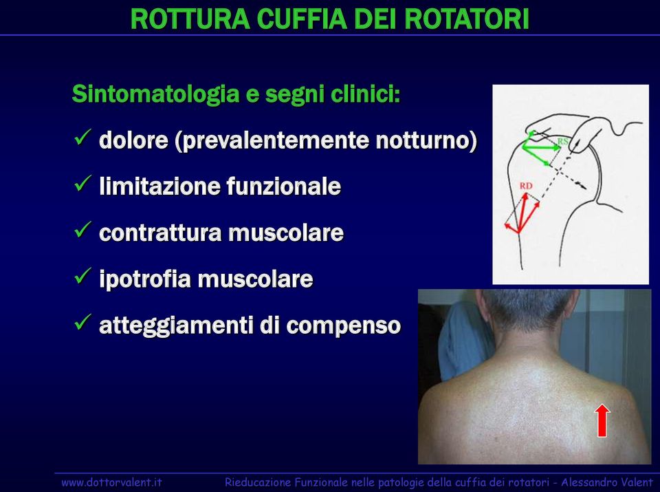 notturno) limitazione funzionale contrattura