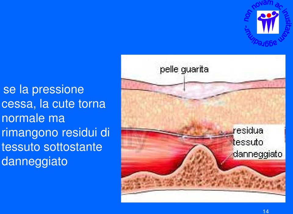 rimangono residui di