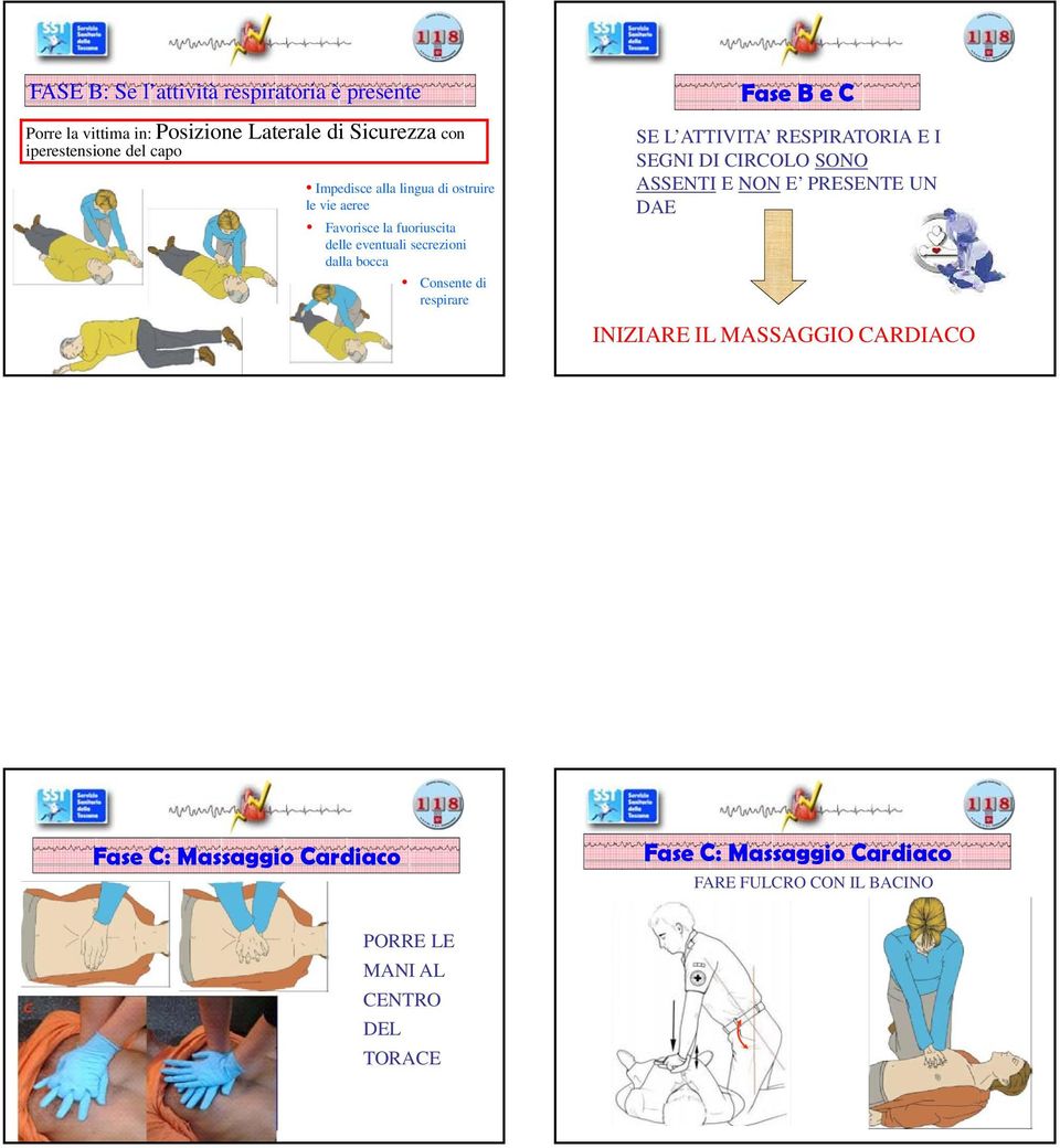 secrezioni dalla bocca Consente di respirare Fase B e C SE L ATTIVITA RESPIRATORIA E I SEGNI DI CIRCOLO SONO