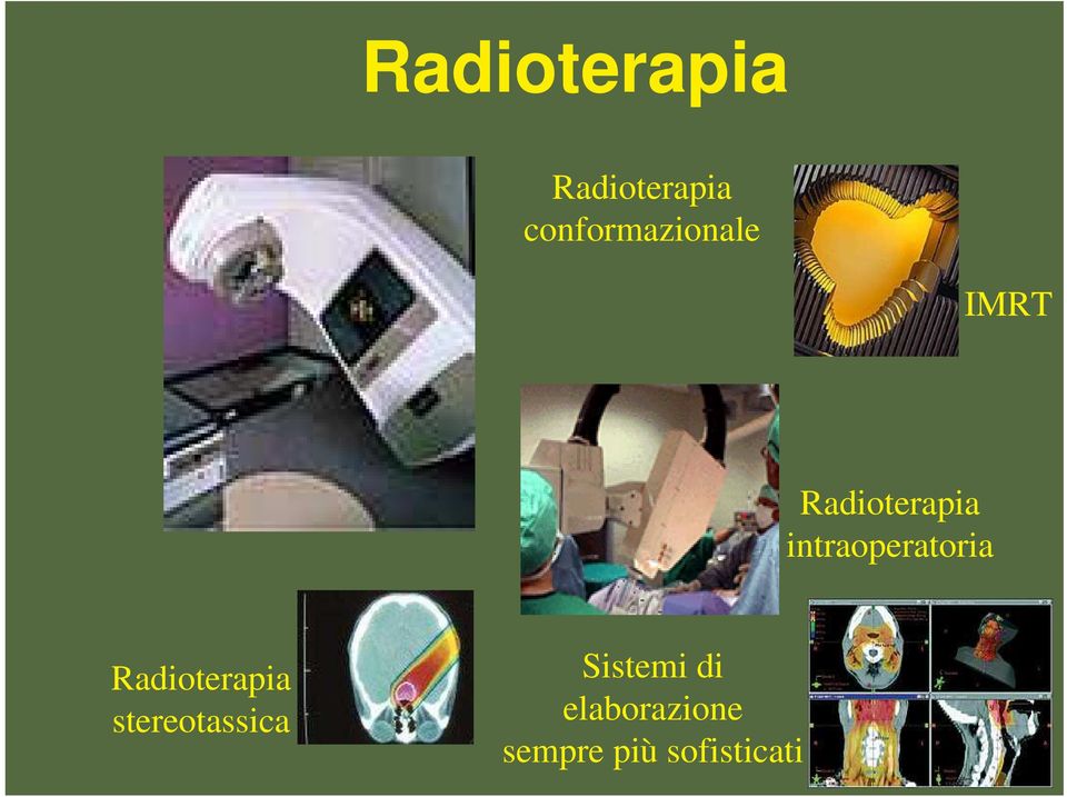 intraoperatoria Radioterapia