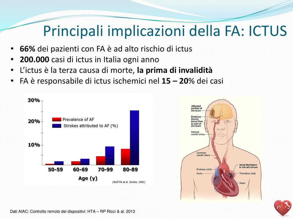 000 casi di ictus in Italia ogni anno L ictus è la terza causa di morte, la