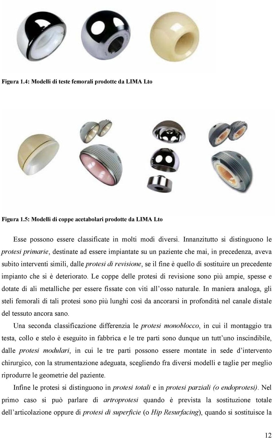 di sostituire un precedente impianto che si è deteriorato. Le coppe delle protesi di revisione sono più ampie, spesse e dotate di ali metalliche per essere fissate con viti all osso naturale.