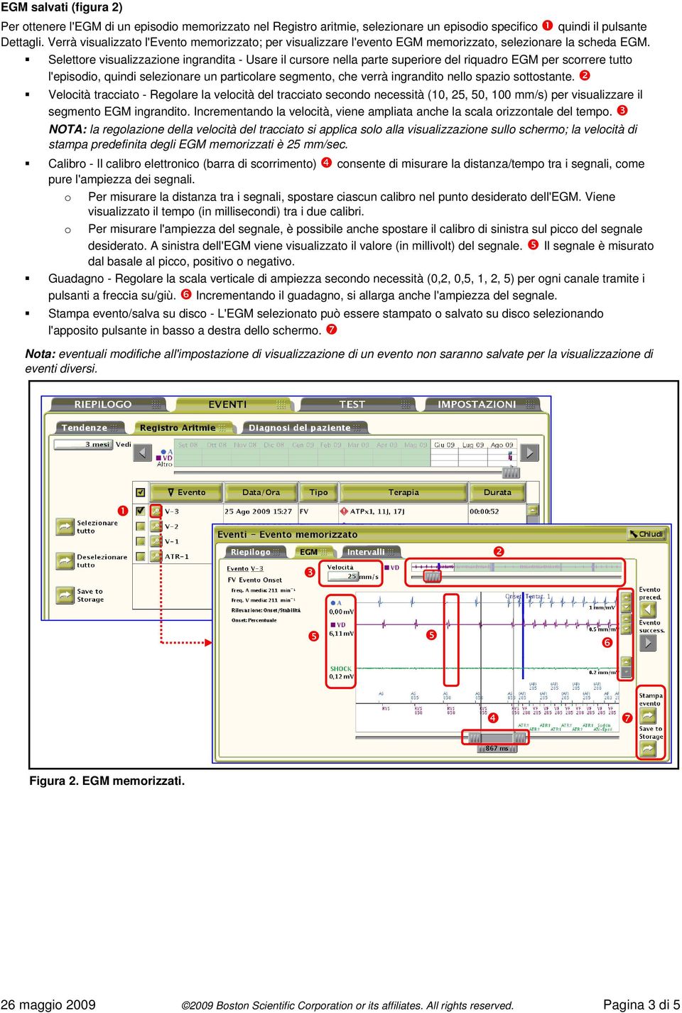 Selettore visualizzazione ingrandita - Usare il cursore nella parte superiore del riquadro EGM per scorrere tutto l'episodio, quindi selezionare un particolare segmento, che verrà ingrandito nello