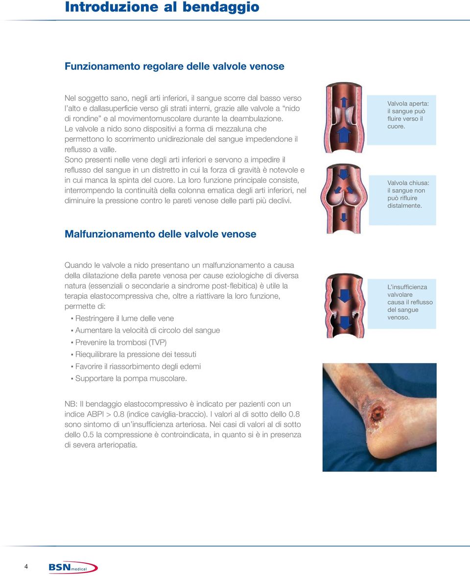 Le valvole a nido sono dispositivi a forma di mezzaluna che permettono lo scorrimento unidirezionale del sangue impedendone il reflusso a valle.