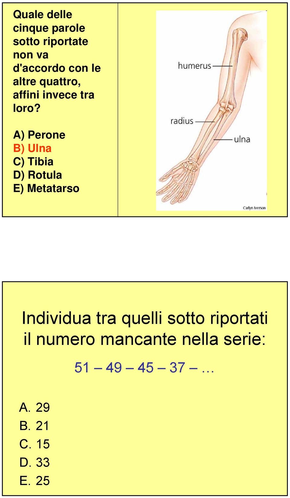 A) Perone B) Ulna C) Tibia D) Rotula E) Metatarso Individua tra