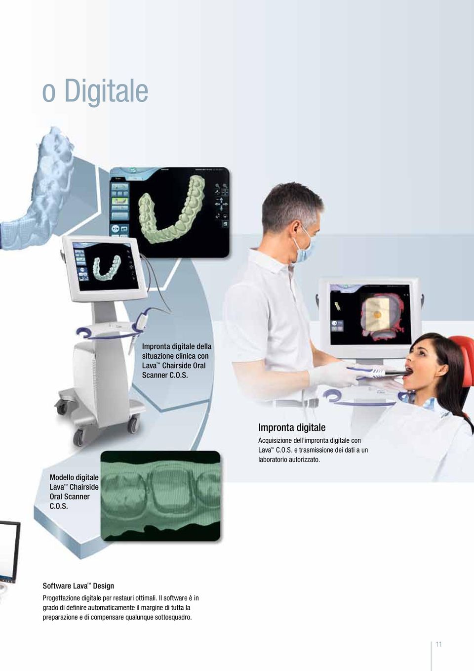 Modello digitale Lava Chairside Oral Scanner C.O.S. Software Lava Design Progettazione digitale per restauri ottimali.
