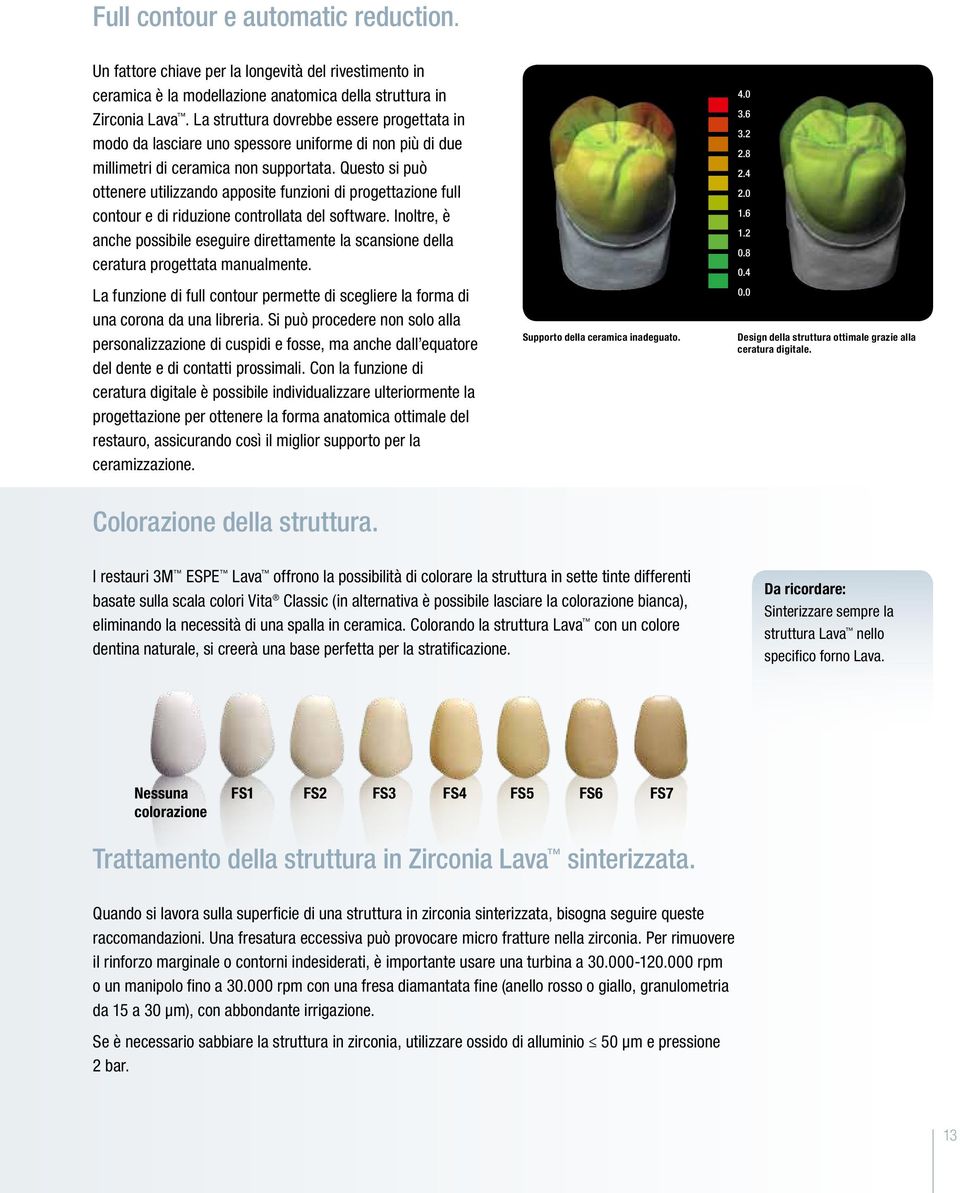 Questo si può ottenere utilizzando apposite funzioni di progettazione full contour e di riduzione controllata del software.