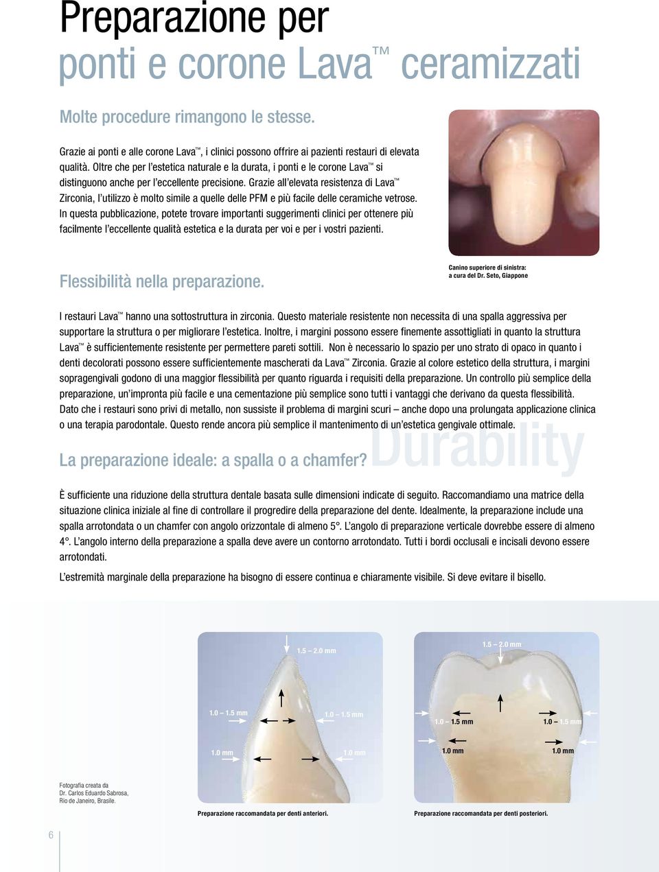 Grazie all elevata resistenza di Lava Zirconia, l utilizzo è molto simile a quelle delle PFM e più facile delle ceramiche vetrose.