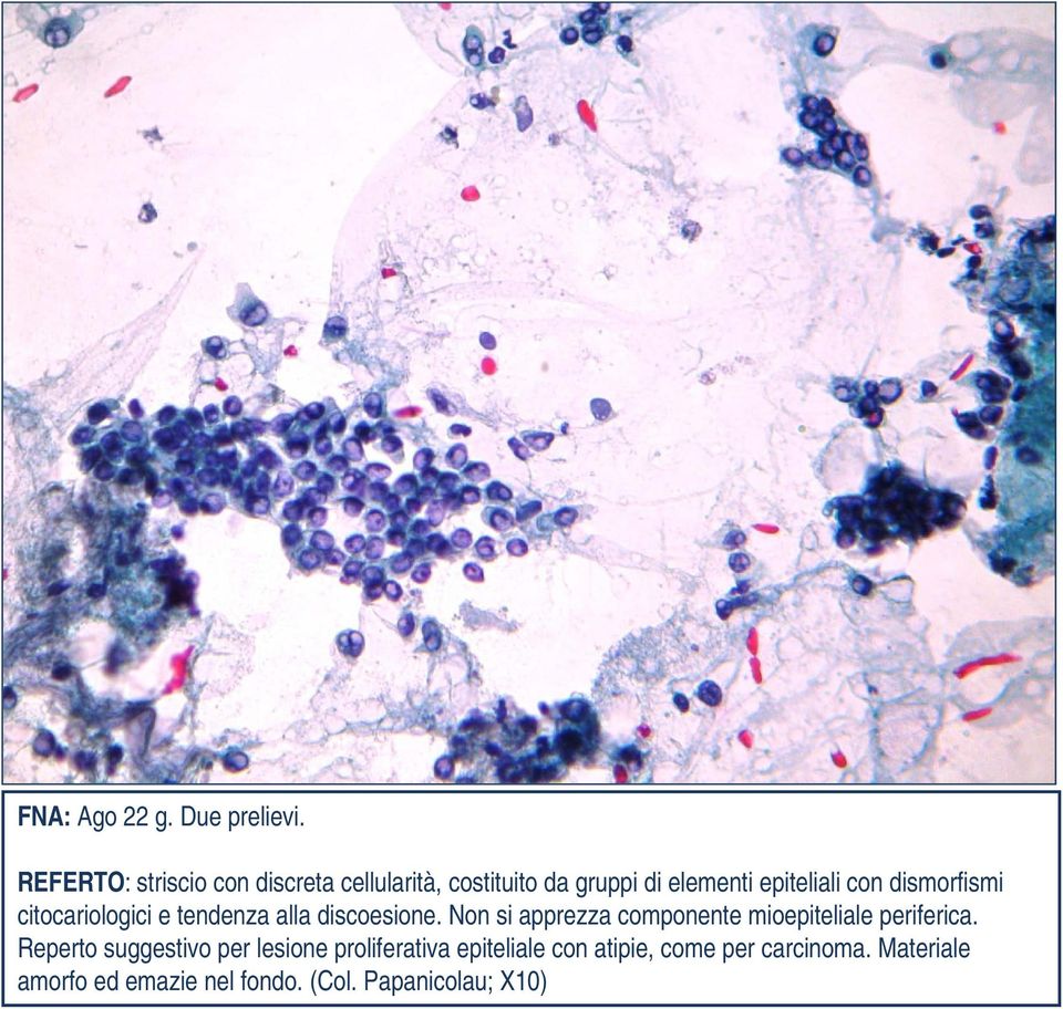 dismorfismi citocariologici e tendenza alla discoesione.