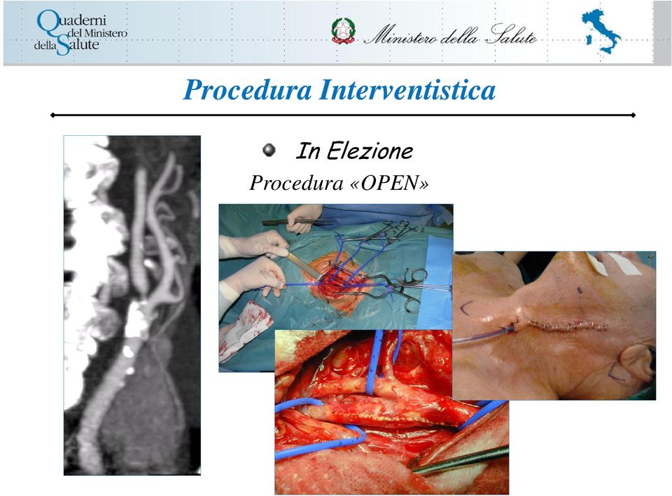 Procedura