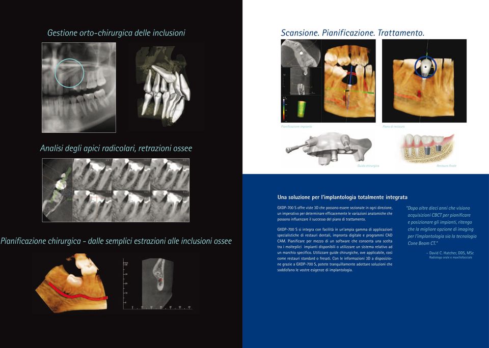 chirurgica - dalle semplici estrazioni alle inclusioni ossee GXDP-700 S offre viste 3D che possono essere sezionate in ogni direzione, un imperativo per determinare efficacemente le variazioni