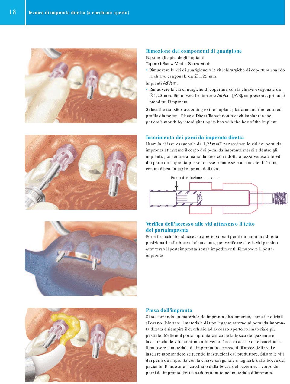 Rimuovere l estensore AdVent [AVE], se presente, prima di prendere l impronta. Select the transfers according to the implant platform and the required profile diameters.