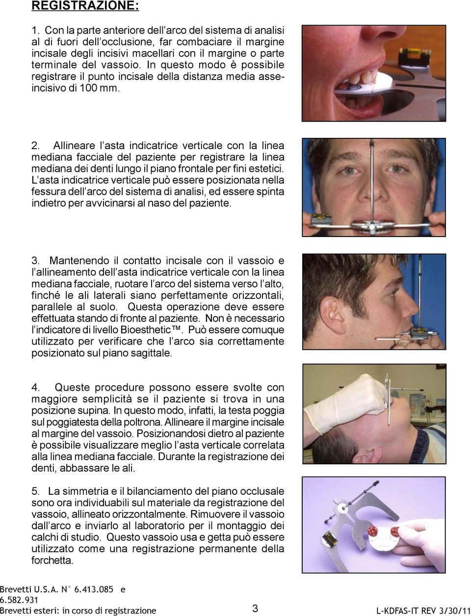 In questo modo è possibile registrare il punto incisale della distanza media asseincisivo di 100 mm. 2.