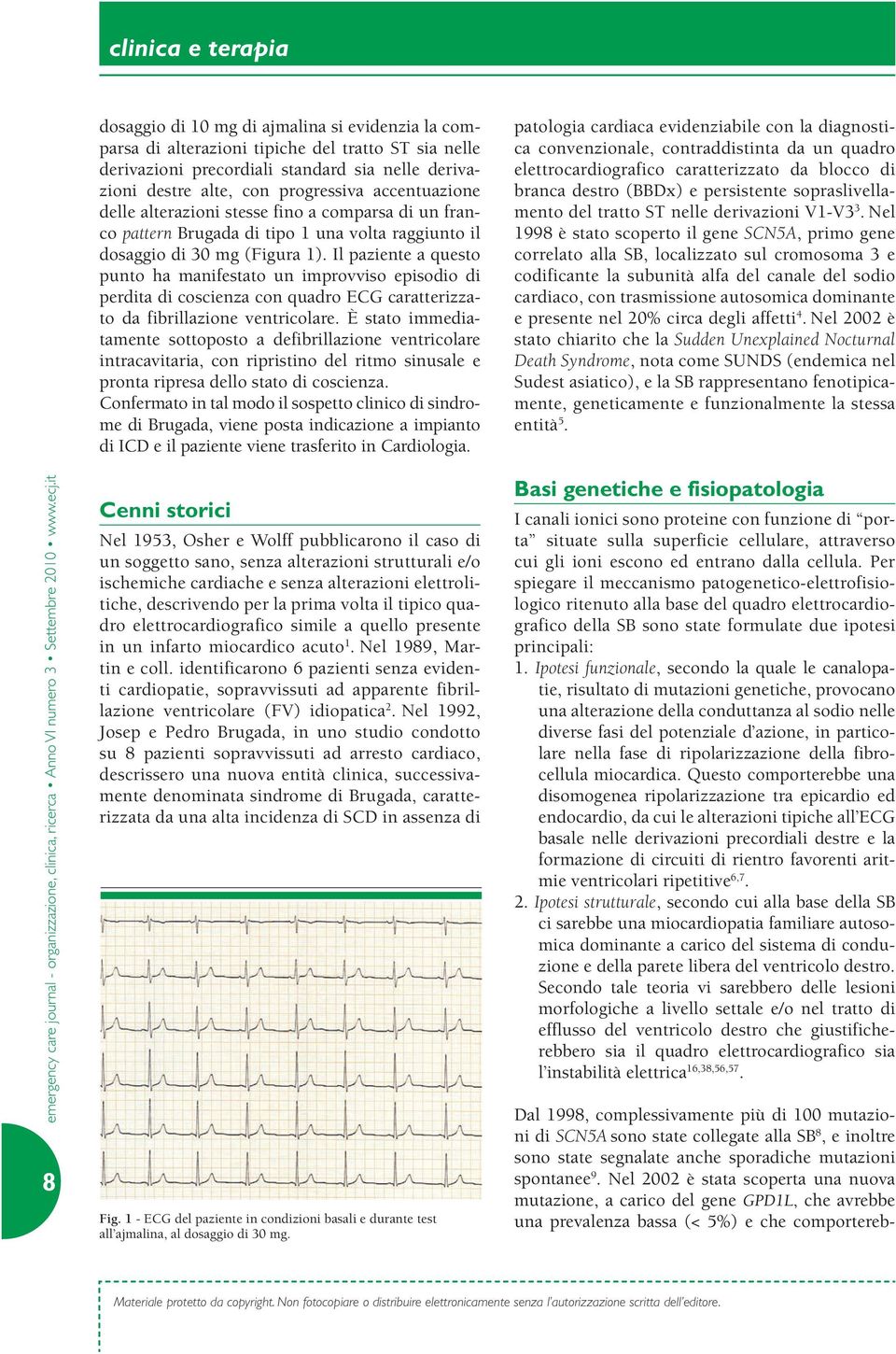 Il paziente a questo punto ha manifestato un improvviso episodio di perdita di coscienza con quadro ECG caratterizzato da fibrillazione ventricolare.