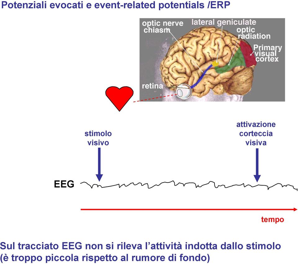 tti ità i d tt d ll ti l ul tracciato EEG non si rileva l