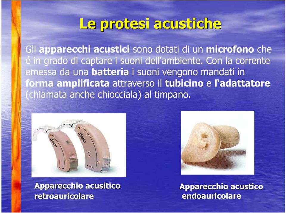 Con la corrente emessa da una batteria i suoni vengono mandati in forma amplificata