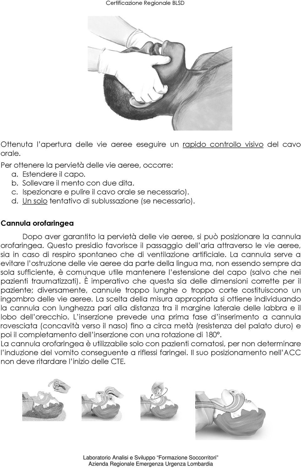 Questo presidio favorisce il passaggio dell aria attraverso le vie aeree, sia in caso di respiro spontaneo che di ventilazione artificiale.