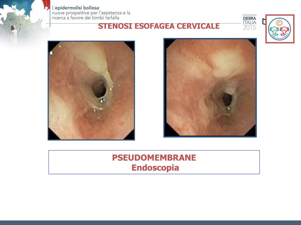 CERVICALE