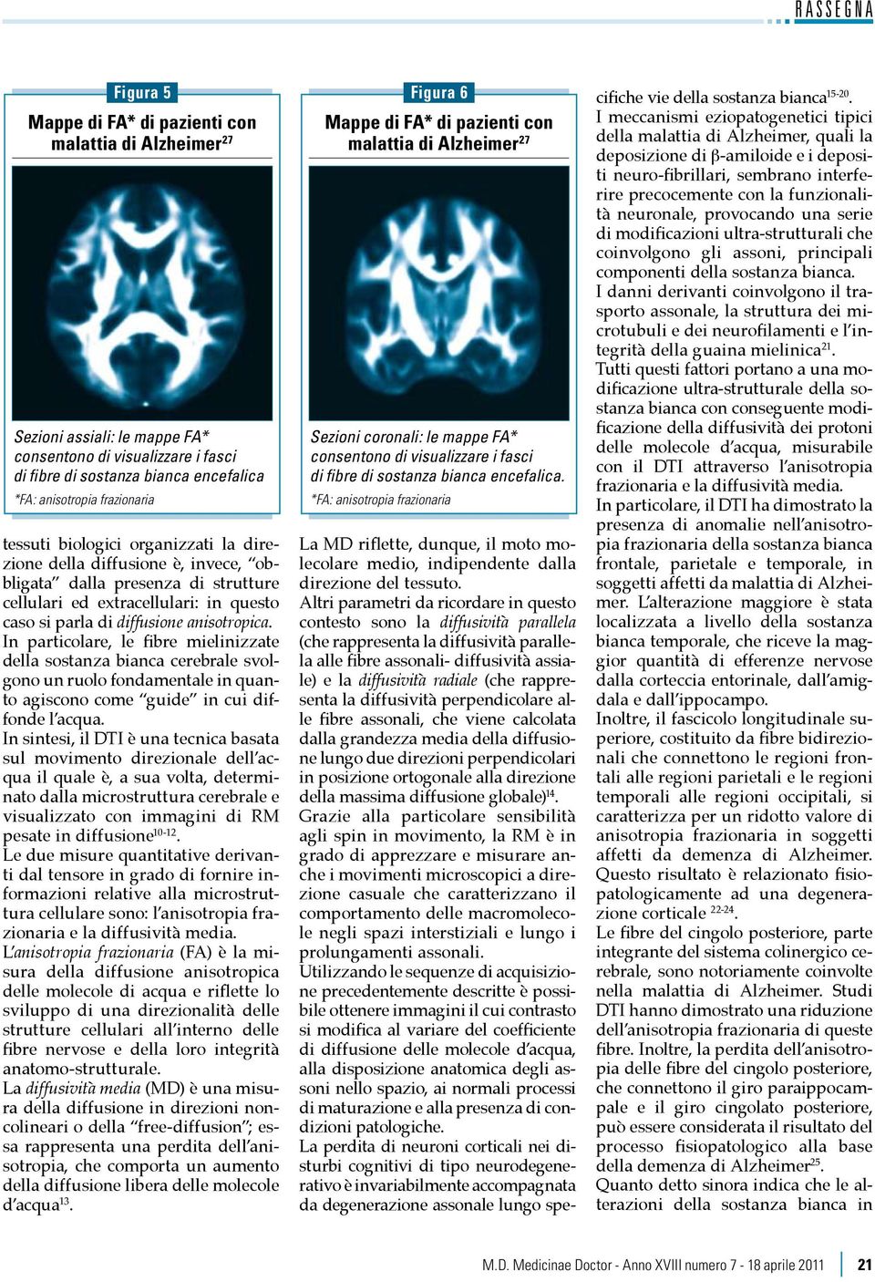 In particolare, le fibre mielinizzate della sostanza bianca cerebrale svolgono un ruolo fondamentale in quanto agiscono come guide in cui diffonde l acqua.