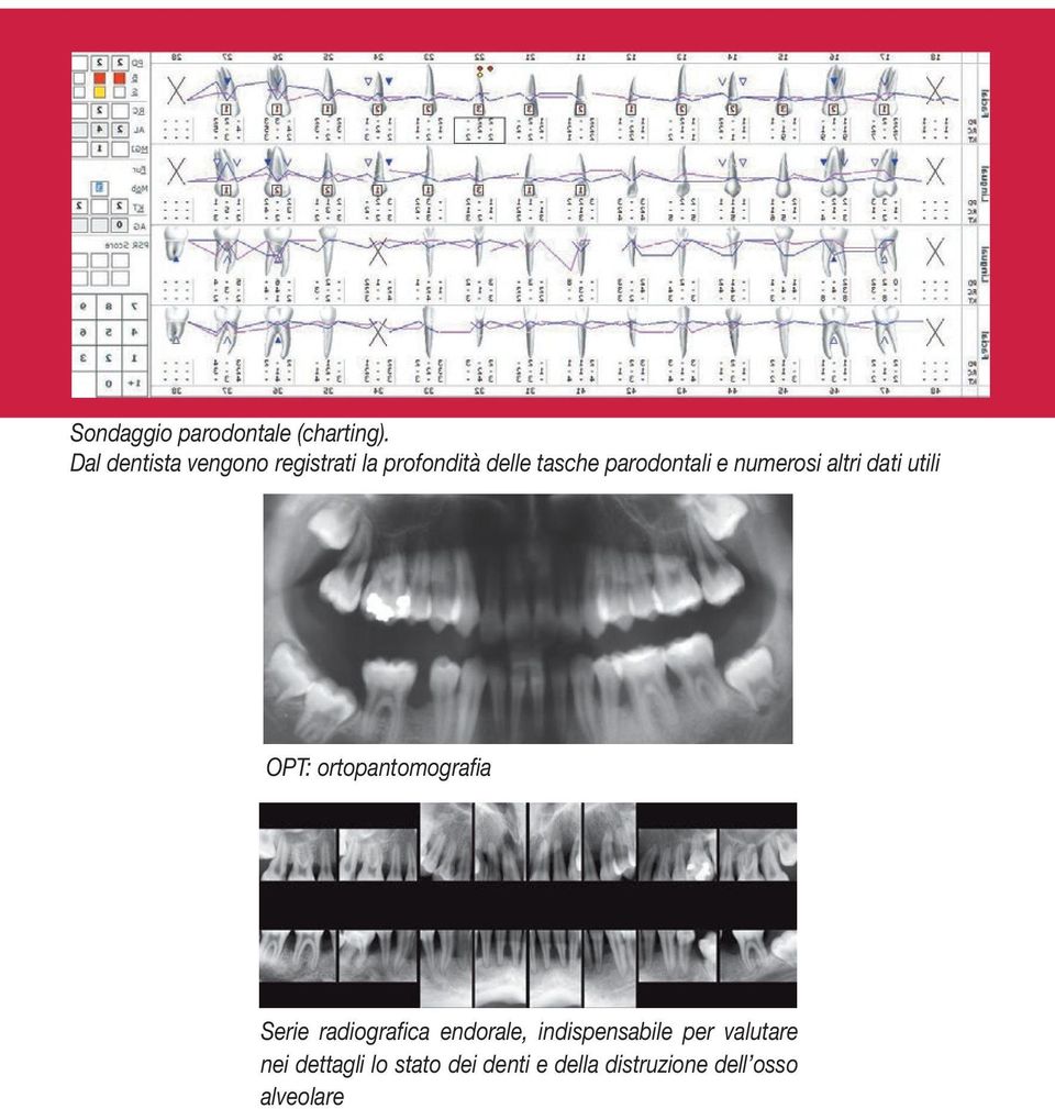 e numerosi altri dati utili OPT: ortopantomografia Serie radiografica