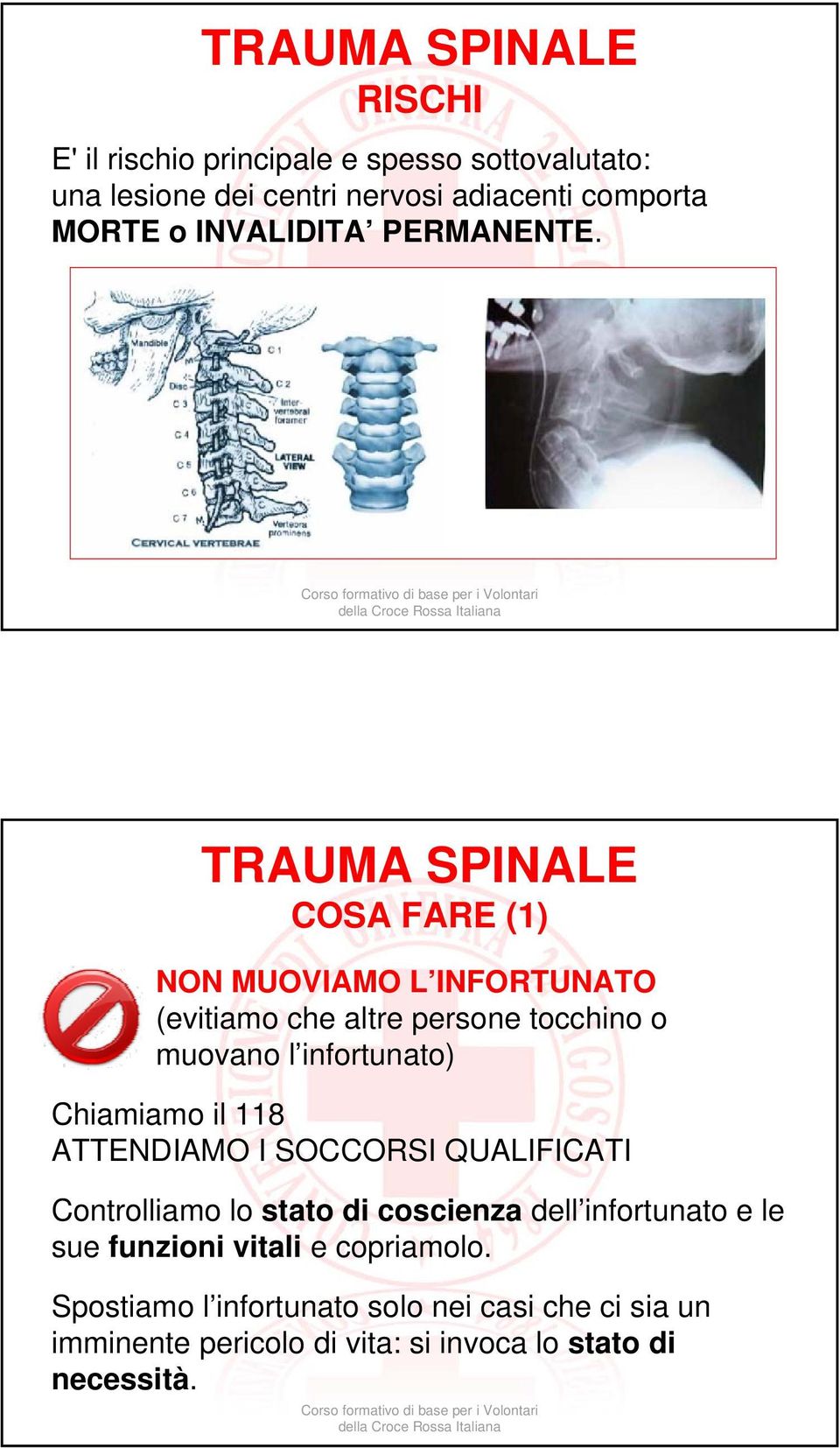 TRAUMA SPINALE COSA FARE (1) NON MUOVIAMO L INFORTUNATO (evitiamo che altre persone tocchino o muovano l infortunato) Chiamiamo il