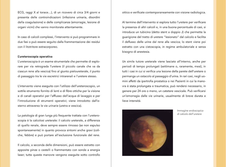 In caso di calcoli complessi, l intervento si può programmare in due fasi o può essere seguito dalla frammentazione dei residui con il litotritore extracorporeo.