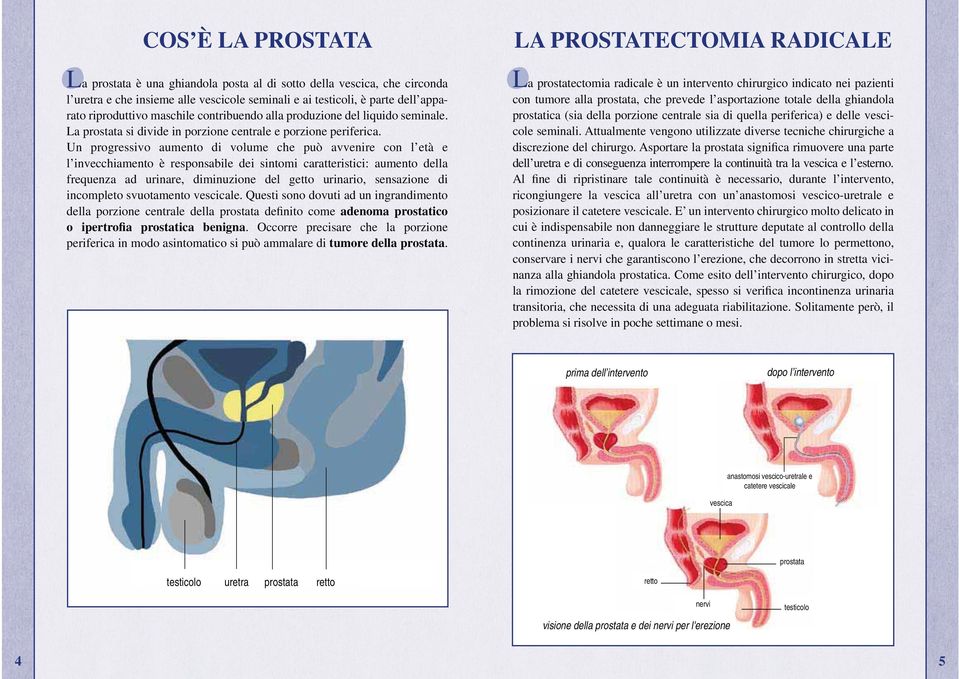 Un progressivo aumento di volume che può avvenire con l età e l invecchiamento è responsabile dei sintomi caratteristici: aumento della frequenza ad urinare, diminuzione del getto urinario,