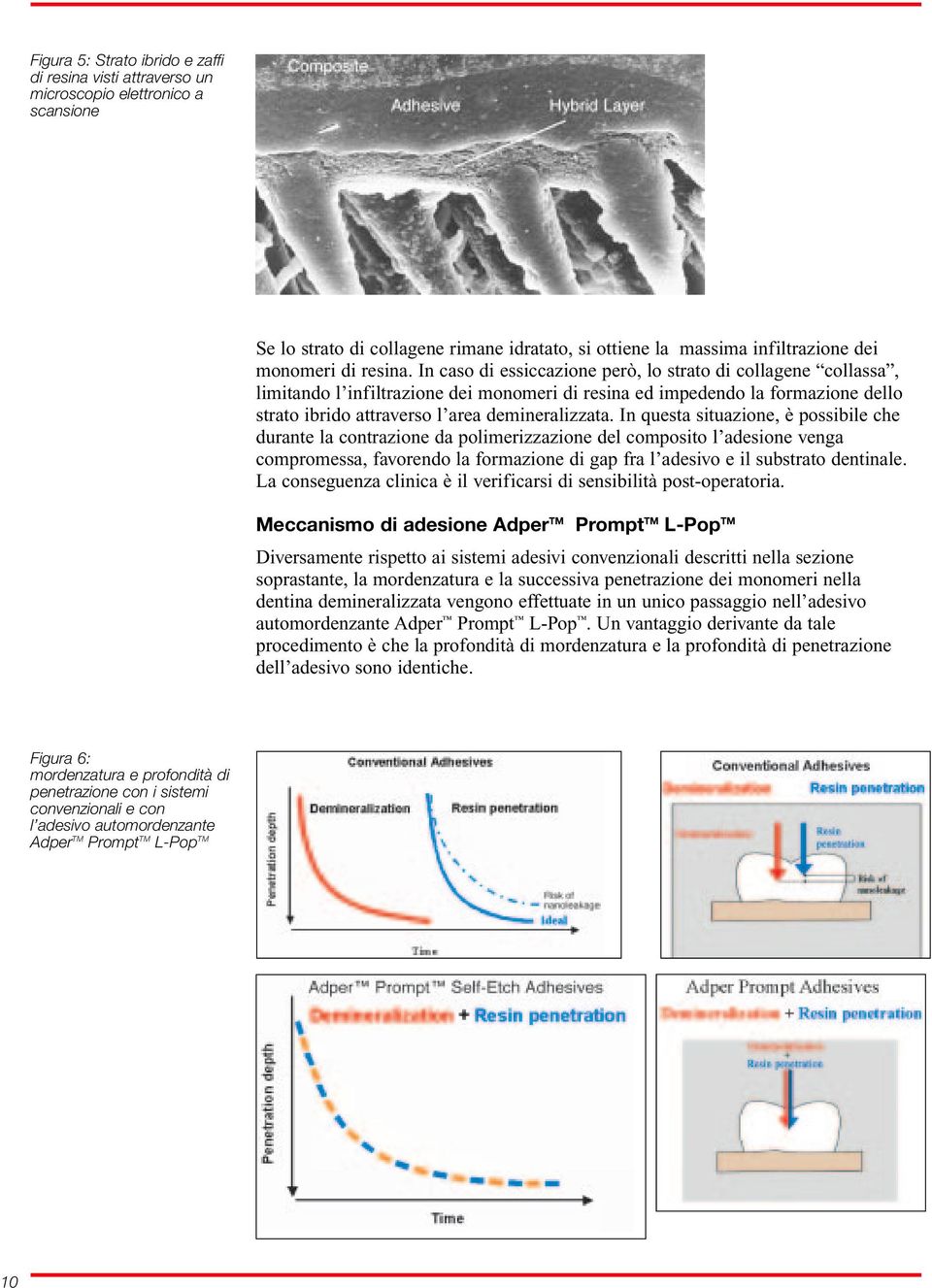 In questa situazione, è possibile che durante la contrazione da polimerizzazione del composito l adesione venga compromessa, favorendo la formazione di gap fra l adesivo e il substrato dentinale.