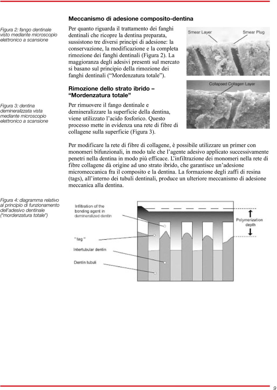 completa rimozione dei fanghi dentinali (Figura 2). La maggioranza degli adesivi presenti sul mercato si basano sul principio della rimozione dei fanghi dentinali ( Mordenzatura totale ).