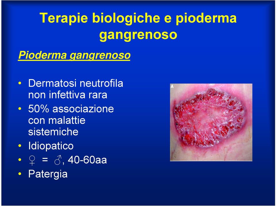 infettiva rara 50% associazione con