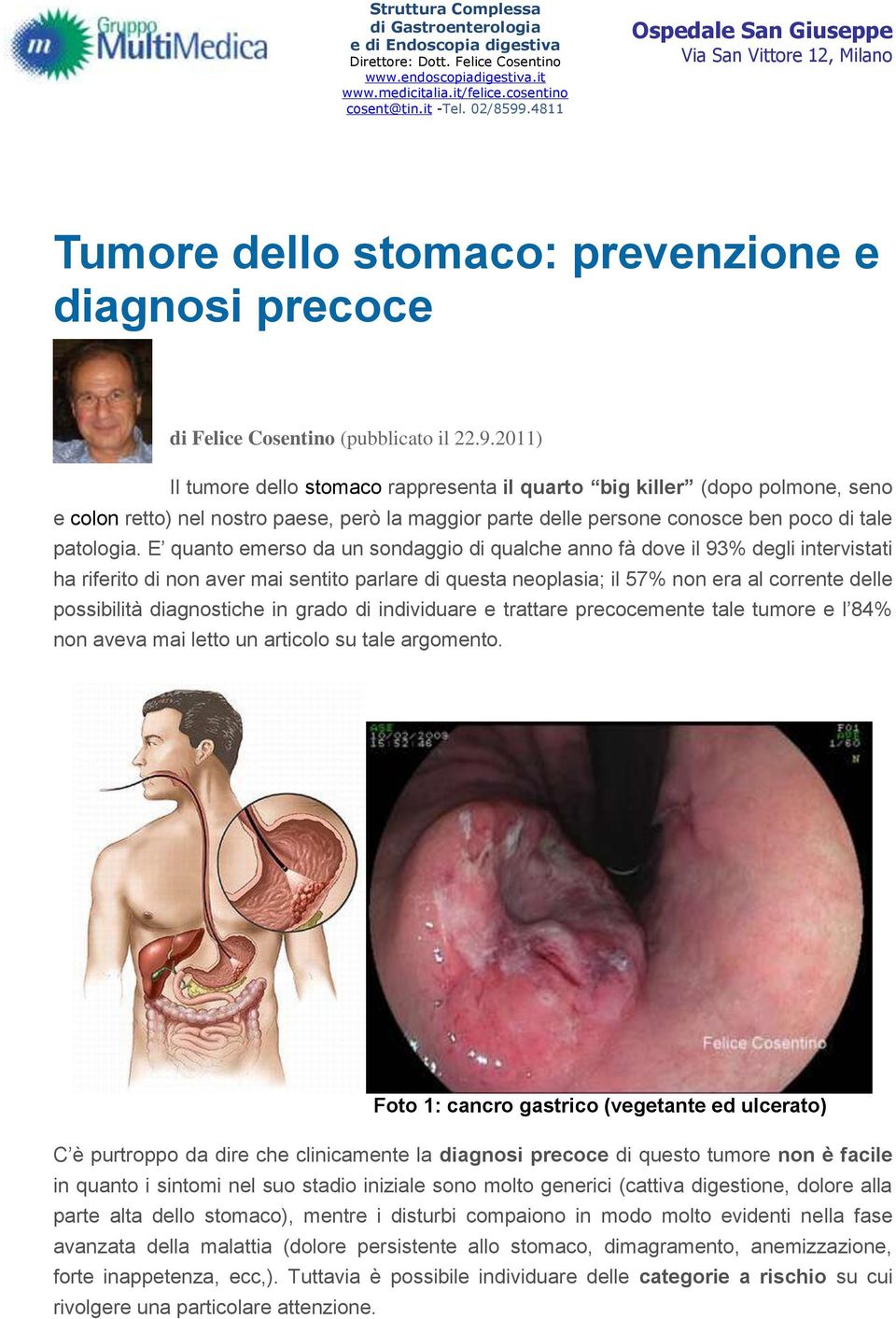 2011) Il tumore dello stomaco rappresenta il quarto big killer (dopo polmone, seno e colon retto) nel nostro paese, però la maggior parte delle persone conosce ben poco di tale patologia.