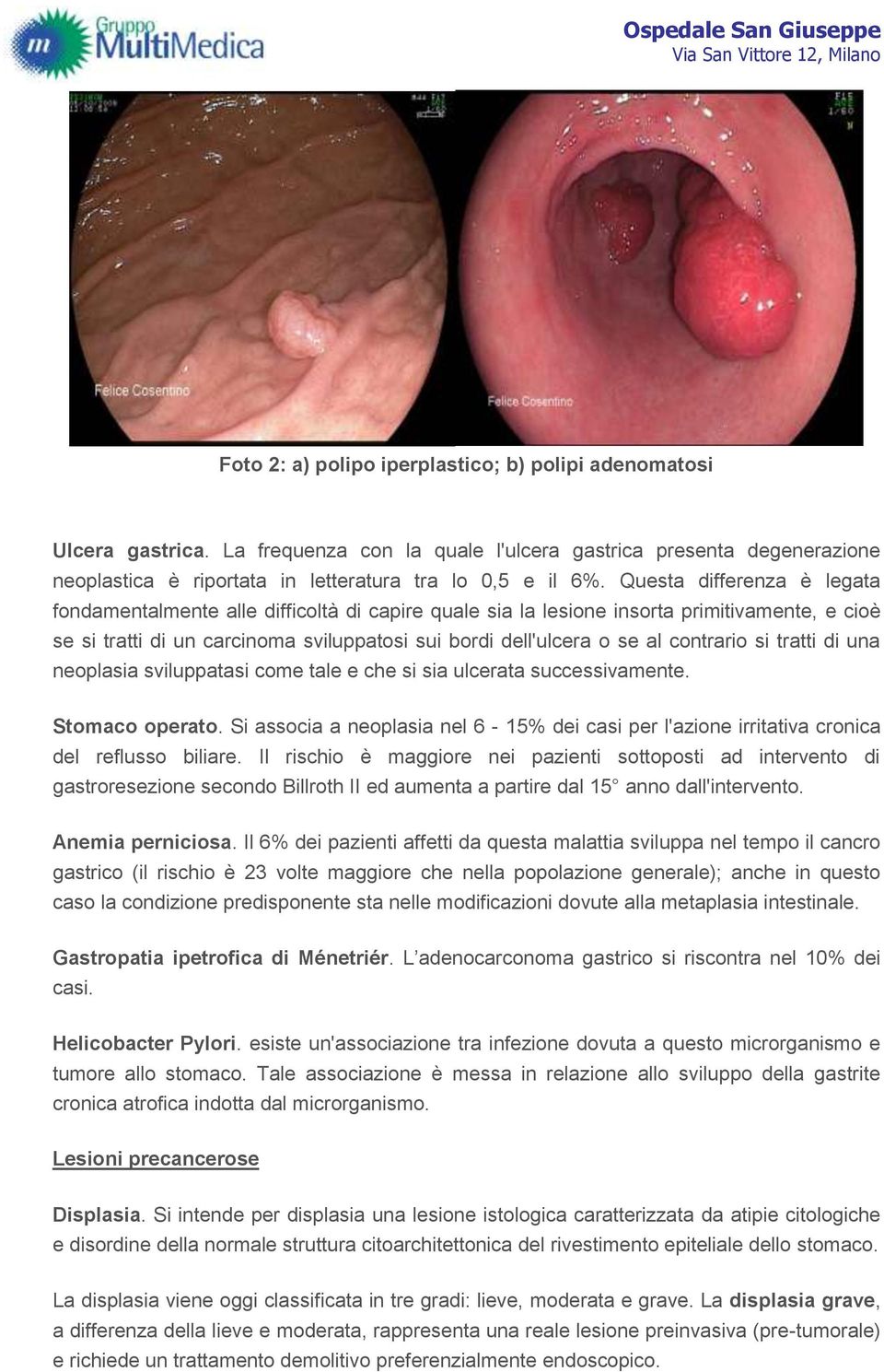 contrario si tratti di una neoplasia sviluppatasi come tale e che si sia ulcerata successivamente. Stomaco operato.