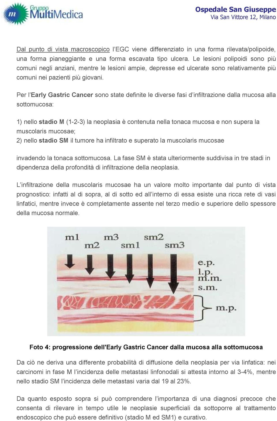 Per l Early Gastric Cancer sono state definite le diverse fasi d infiltrazione dalla mucosa alla sottomucosa: 1) nello stadio M (1-2-3) la neoplasia è contenuta nella tonaca mucosa e non supera la