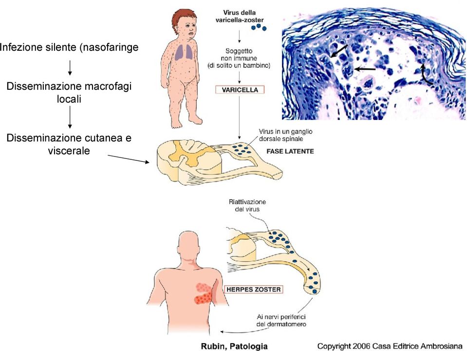 Disseminazione macrofagi