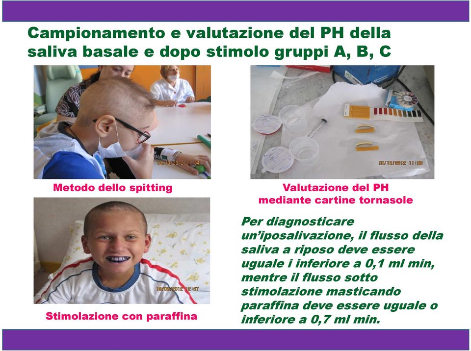 diagnosticare un iposalivazione, il flusso della saliva a riposo deve essere uguale i inferiore a