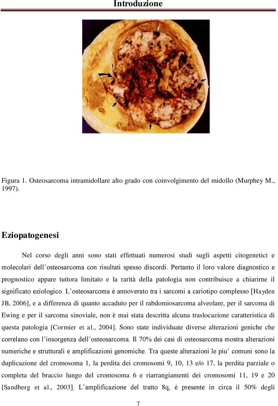 Pertanto il loro valore diagnostico e prognostico appare tuttora limitato e la rarità della patologia non contribuisce a chiarirne il significato eziologico.