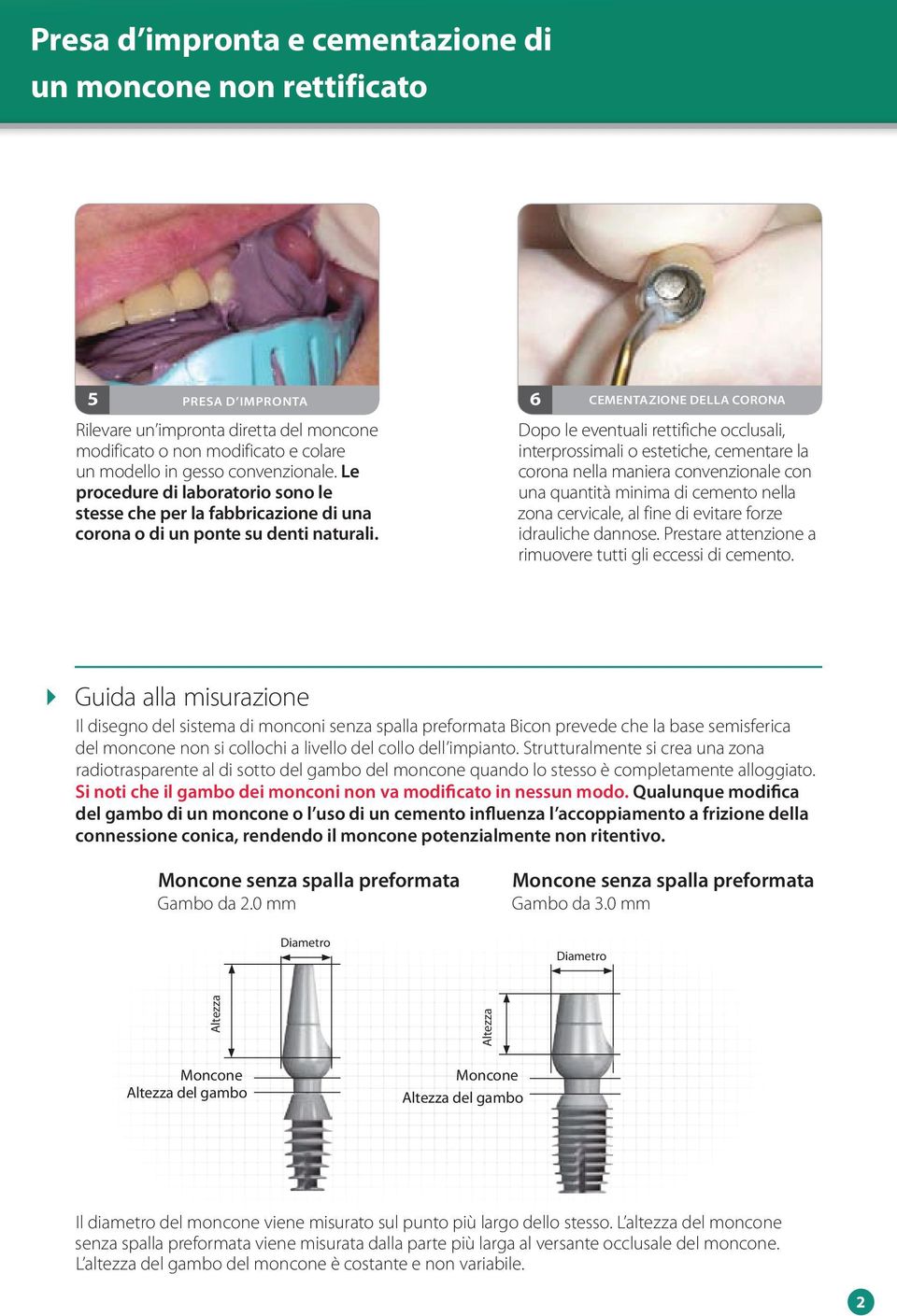 6 CEMENTAZIONE DELLA CORONA Dopo le eventuali rettifiche occlusali, interprossimali o estetiche, cementare la corona nella maniera convenzionale con una quantità minima di cemento nella zona