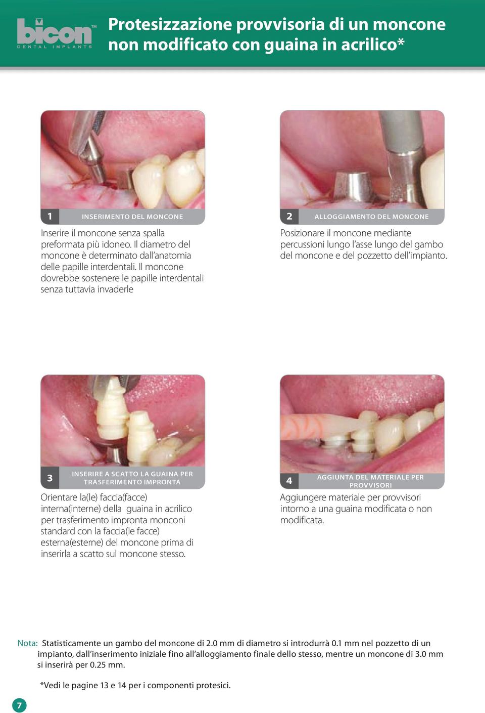 Il moncone dovrebbe sostenere le papille interdentali senza tuttavia invaderle 2 ALLOGGIAMENTO DEL MONCONE Posizionare il moncone mediante percussioni lungo l asse lungo del gambo del moncone e del