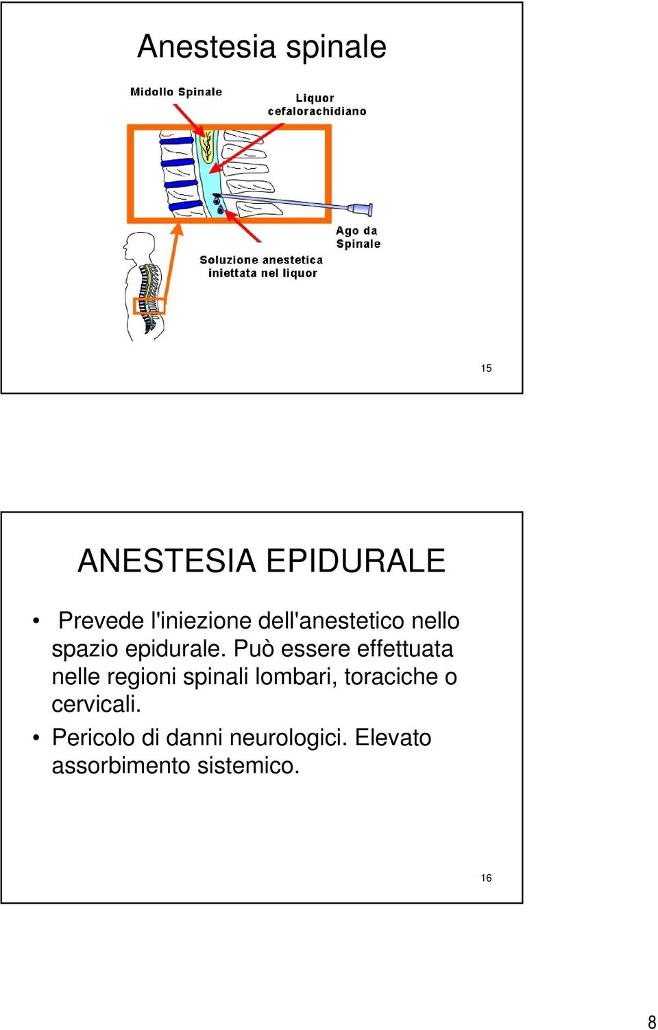 Può essere effettuata nelle regioni spinali lombari,