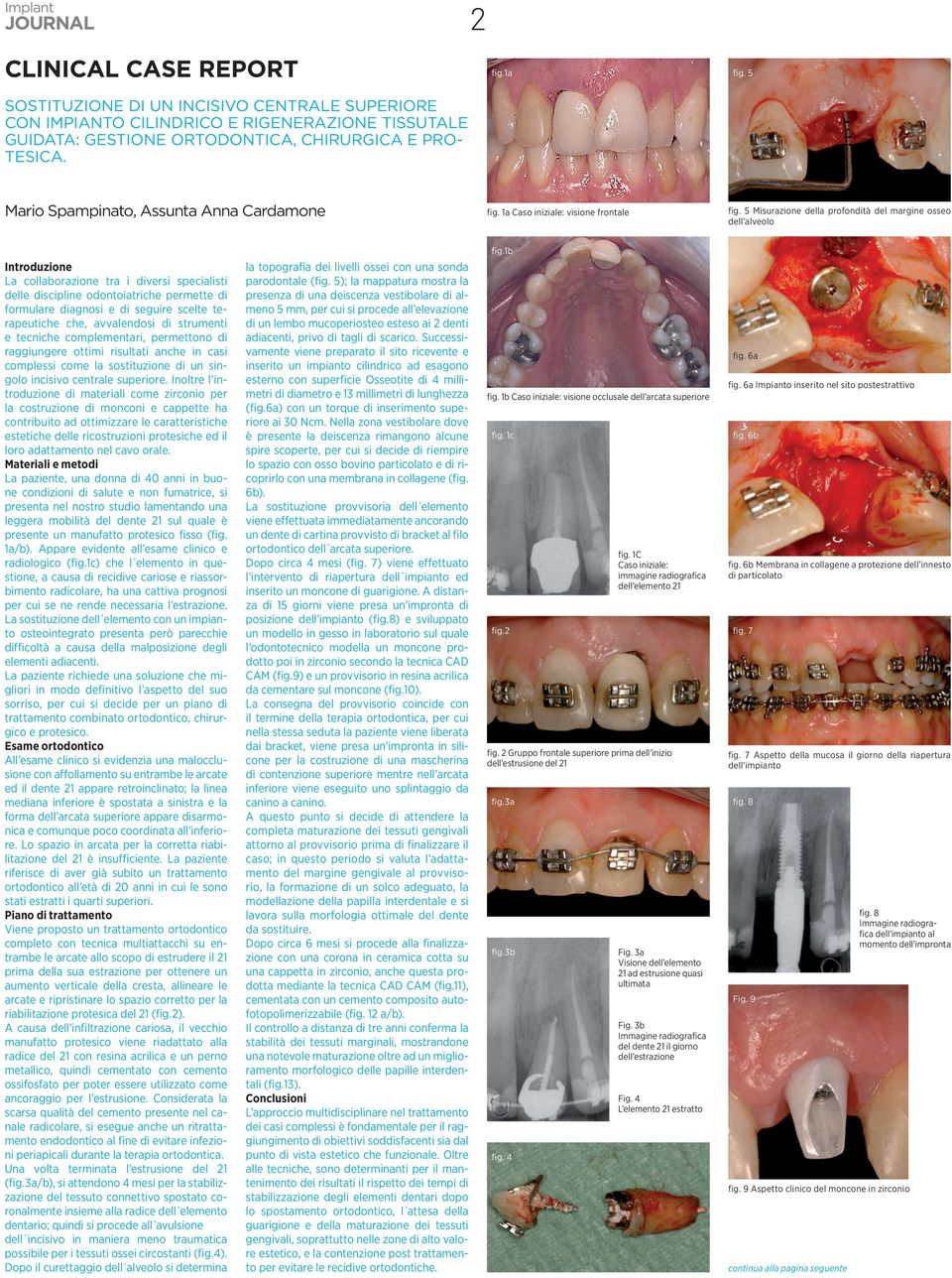 5 Misurazione della profondità del margine osseo dell alveolo Introduzione La collaborazione tra i diversi specialisti delle discipline odontoiatriche permette di formulare diagnosi e di seguire