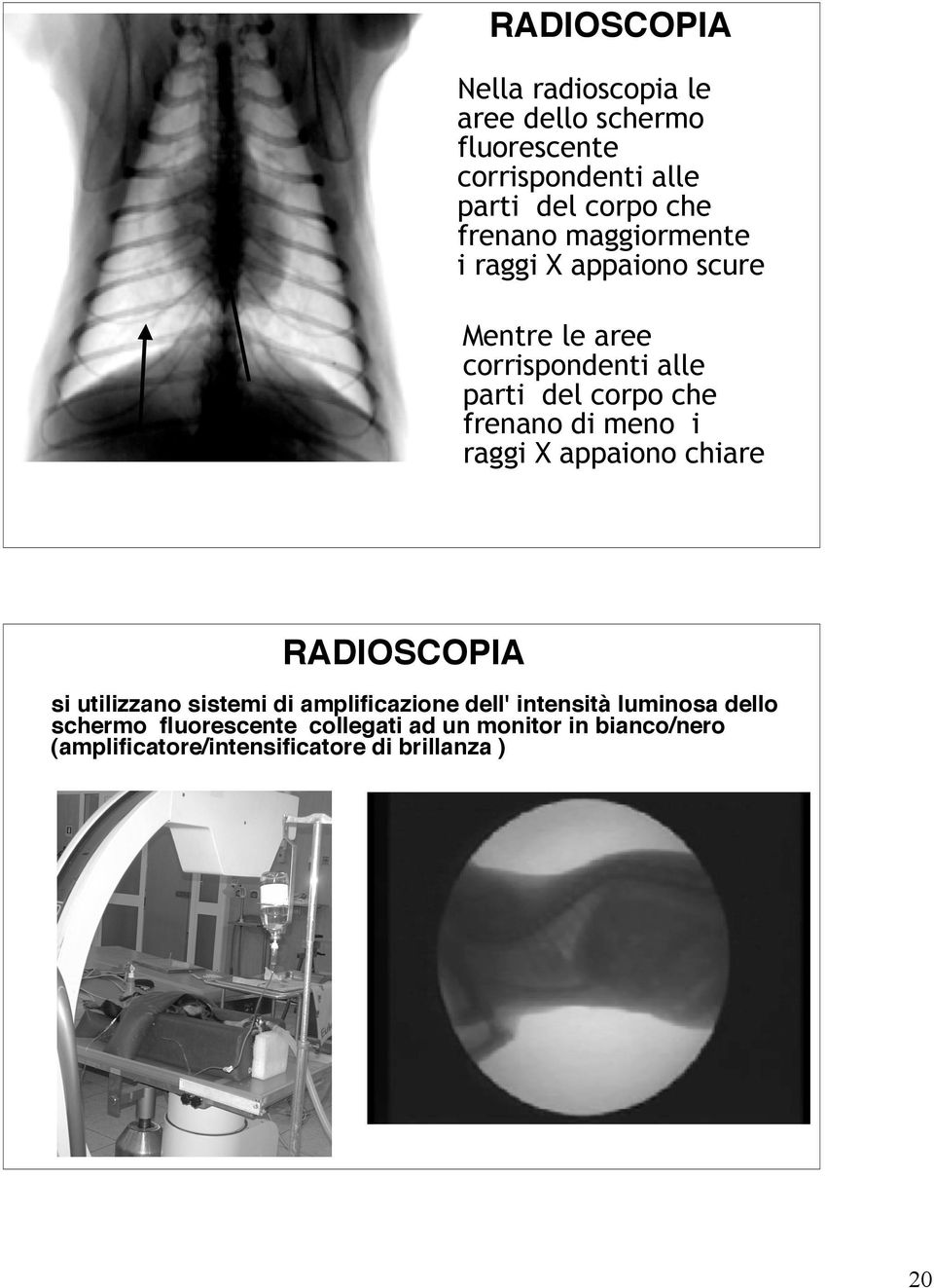 di meno i raggi X appaiono chiare RADIOSCOPIA si utilizzano sistemi di amplificazione dell' intensità