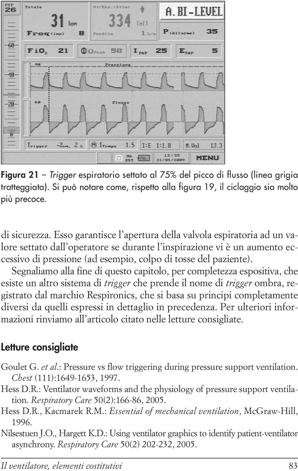 Segnaliamo alla fine di questo capitolo, per completezza espositiva, che esiste un altro sistema di trigger che prende il nome di trigger ombra, registrato dal marchio Respironics, che si basa su