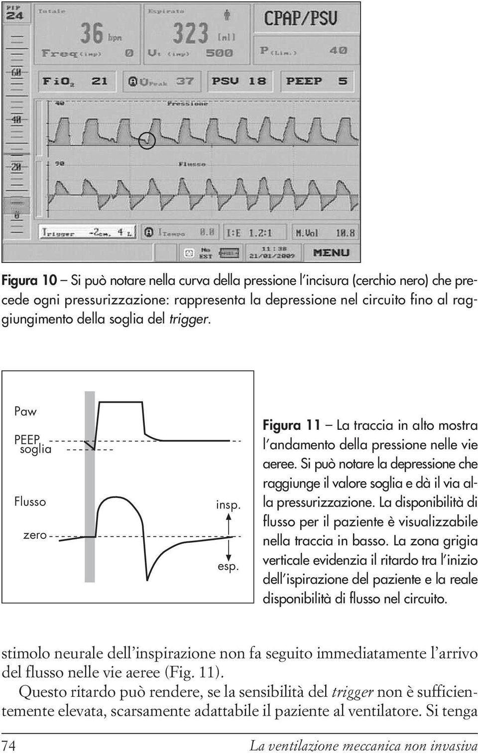 Si può notare la depressione che raggiunge il valore soglia e dà il via alla pressurizzazione. La disponibilità di flusso per il paziente è visualizzabile nella traccia in basso.