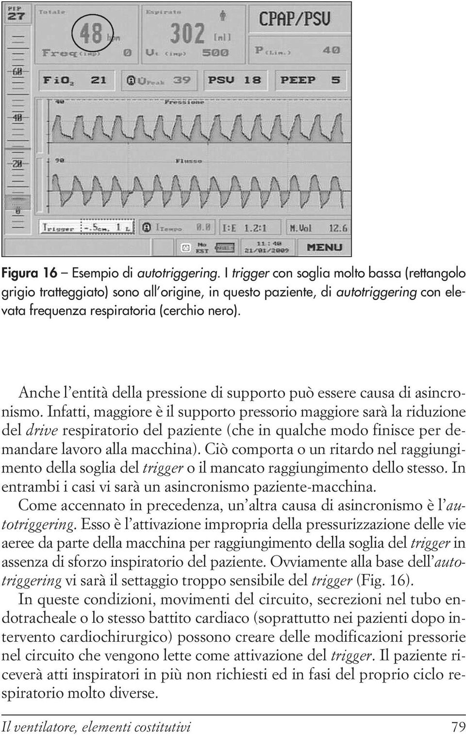 Anche l entità della pressione di supporto può essere causa di asincronismo.