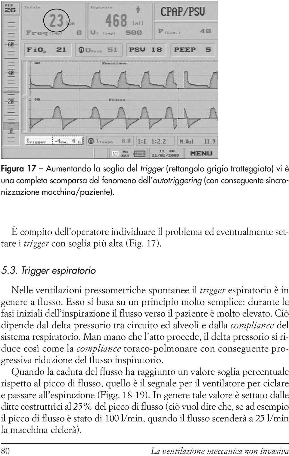 Trigger espiratorio Nelle ventilazioni pressometriche spontanee il trigger espiratorio è in genere a flusso.